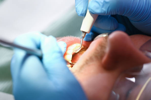 Best Root Canal Emergency Dentist  in Monarch Mill, SC