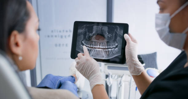Emergency Dental Filling Replacement in SC